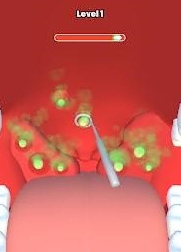 喉科医生3D游戏官方安卓版（Throat Doctor 3D）图片1